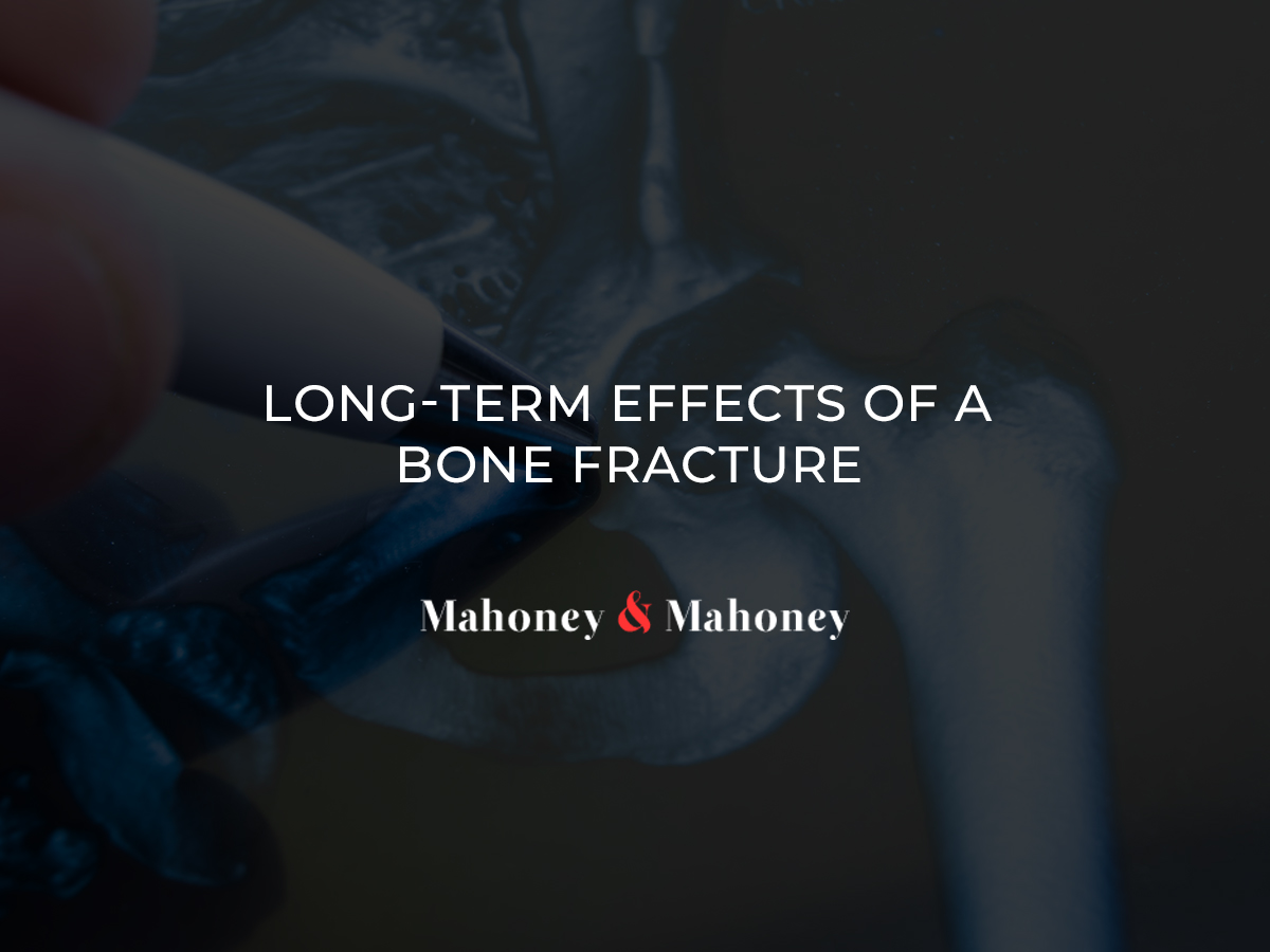 Long-Term Effects of a Bone Fracture